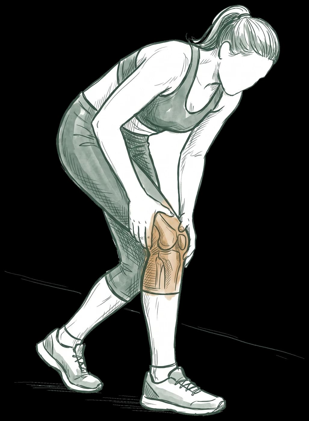 Hand-drawn sketch of a runner stopped mid-run and bending to hold one knee, with the knee joint showing through