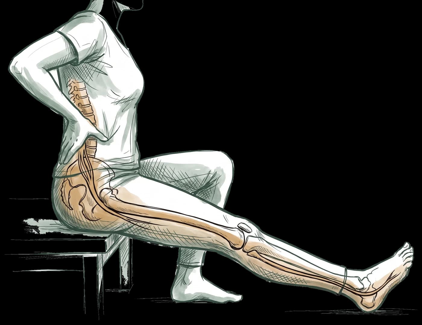 Hand-drawn sketch of a person seated on a low bench, one hand reaching back to press their lower back and the affected leg extended forward, with the lumbar spine and the sciatic nerve traced from the lower back down the leg to the foot