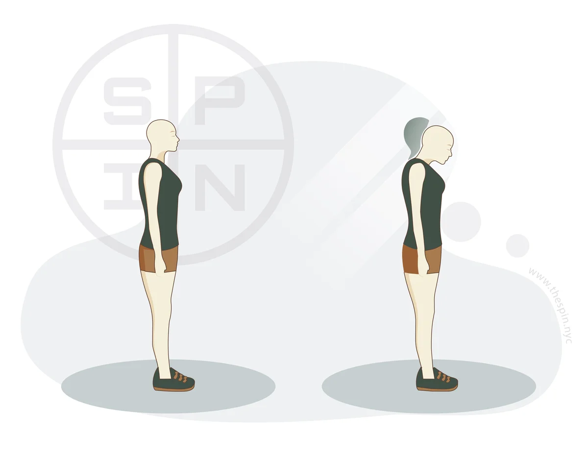 Forward Neck Flexion