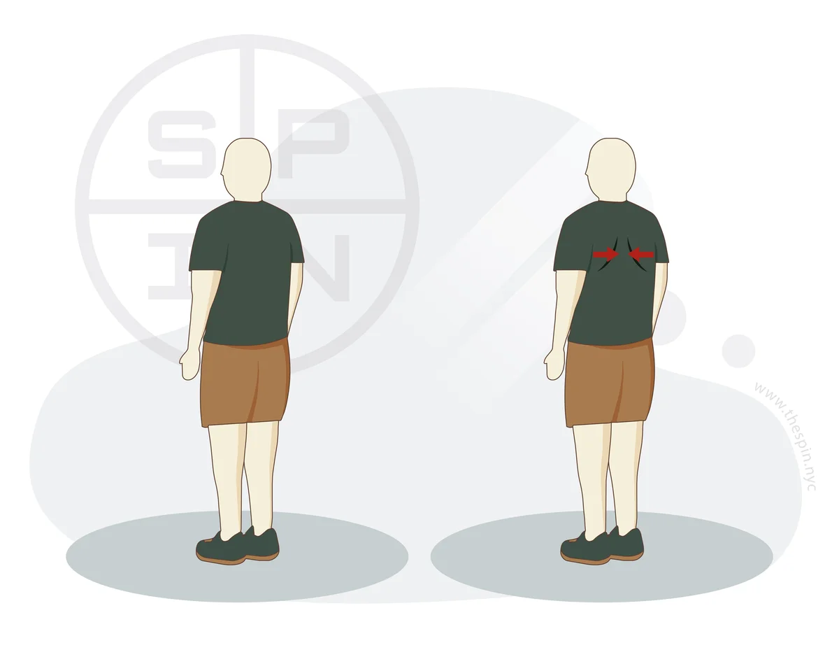 Shoulder Blade Squeeze