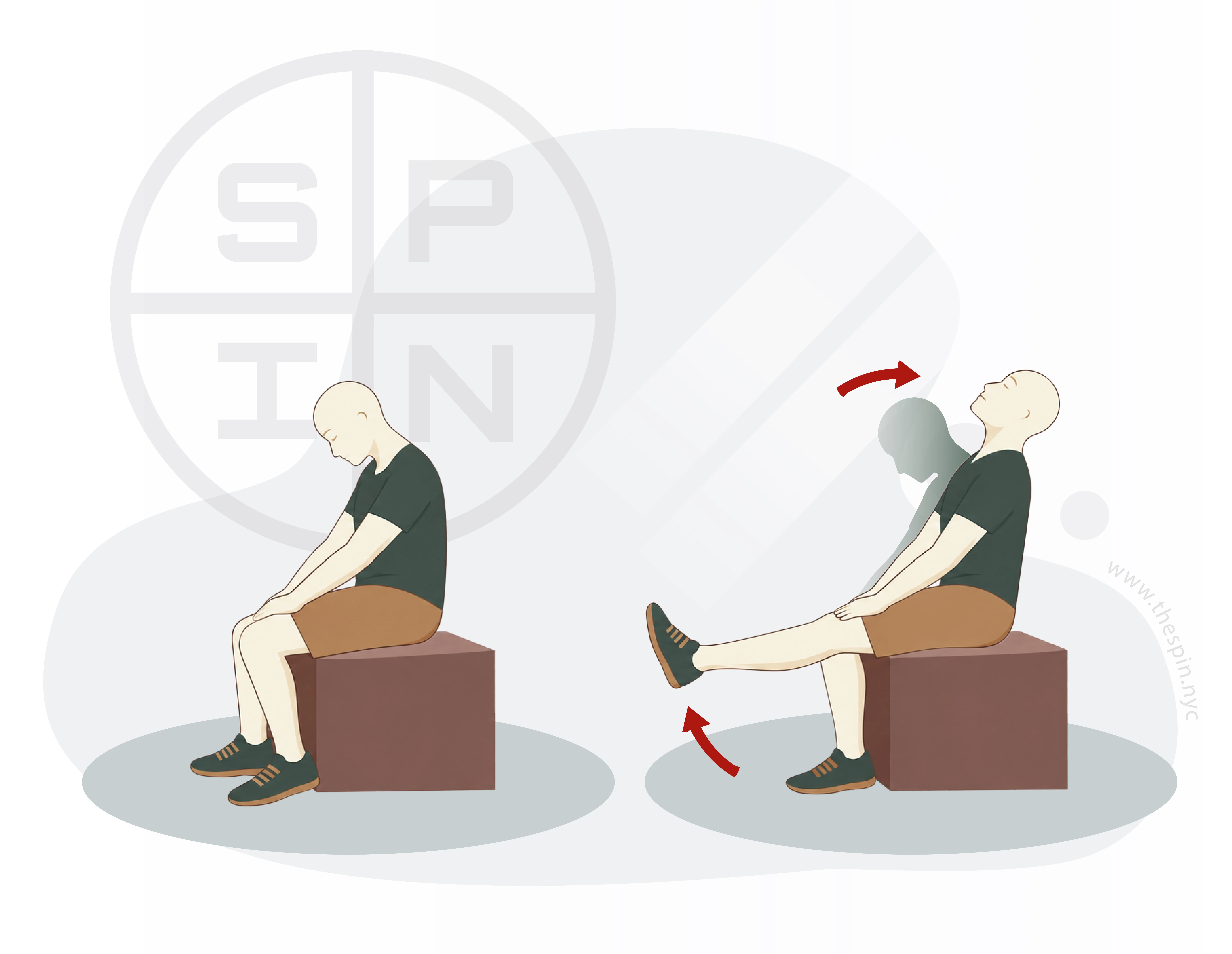 Sciatica