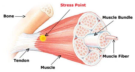 Myofascial pain syndrome treatment doctor specialist NYC — Dr. Febin Melepura