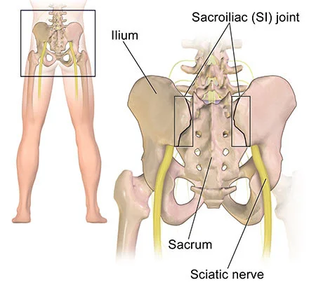 Sacroiliac joint dysfunction treatment doctor specialist NYC — Dr. Febin Melepura