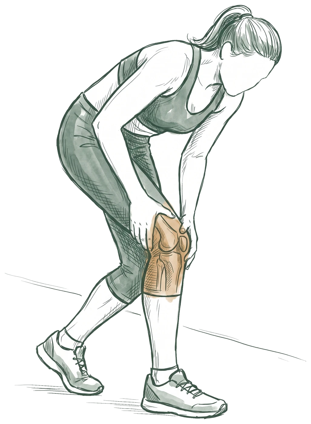 Hand-drawn sketch of a runner stopped mid-run and bending to hold one knee, with the knee joint showing through