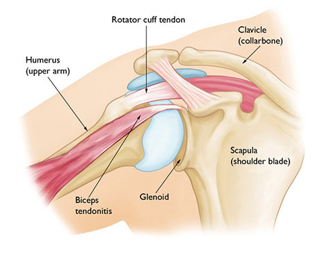 NYC Shoulder Strain Treatment Doctor, Top Shoulder Joint Specialist · Sports Injury Clinic