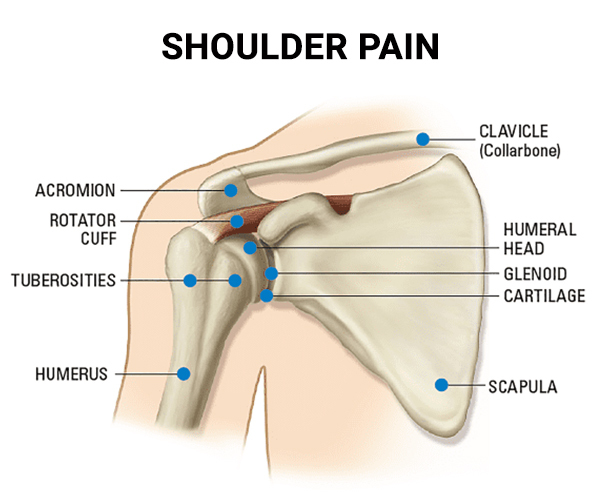 Shoulder Pain Treatment in NYC