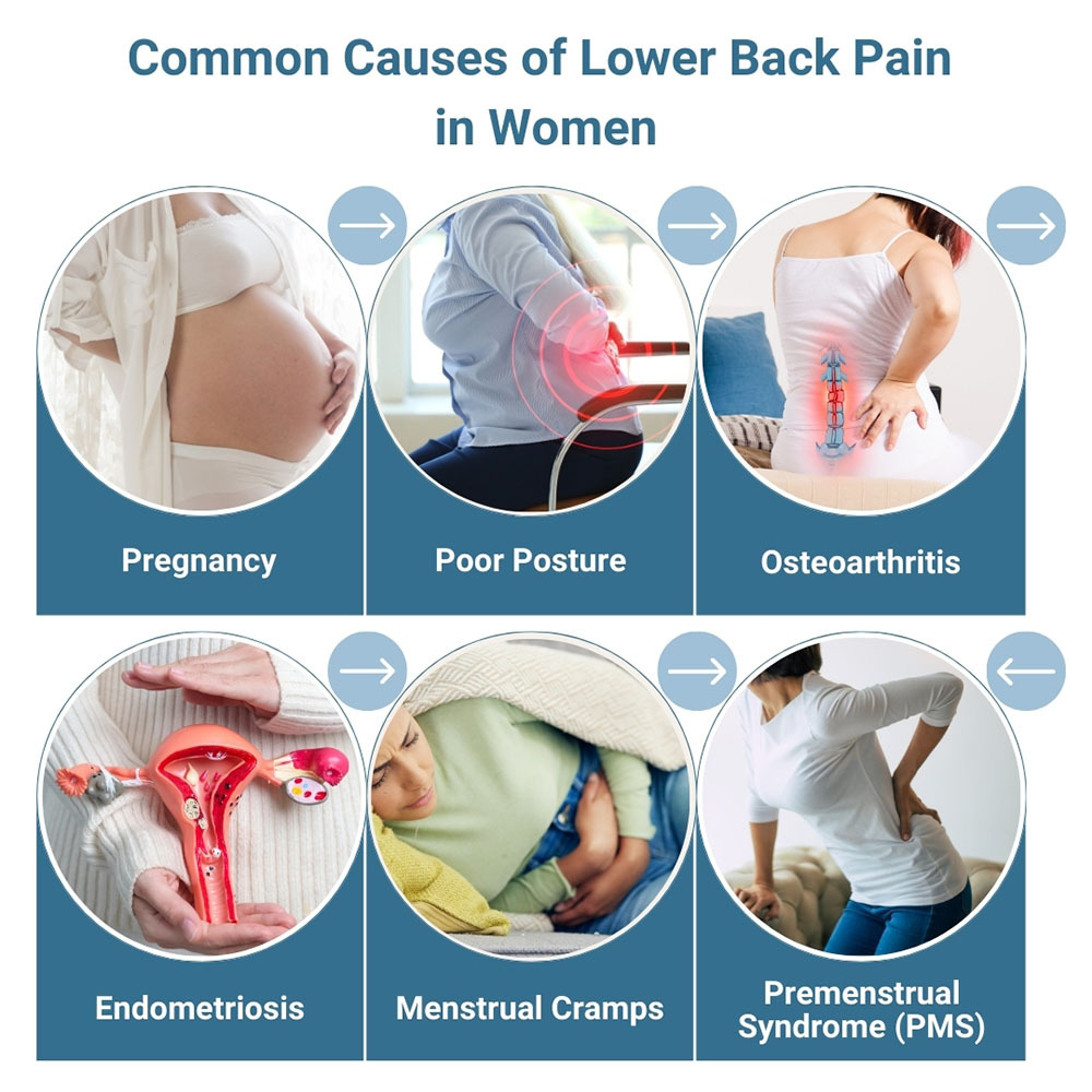 Common Causes of Lower Back Pain in Women